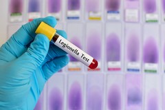 Legionella, campagna di prevenzione ASL Bari