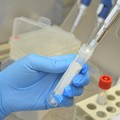 GeneXpert”: lo strumento esclusivo del Laboratorio Clinico Dibattista