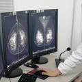 Screening mammografico, al via la campagna di prevenzione