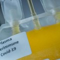 Covid-19, si può donare il plasma all'ospedale della Murgia