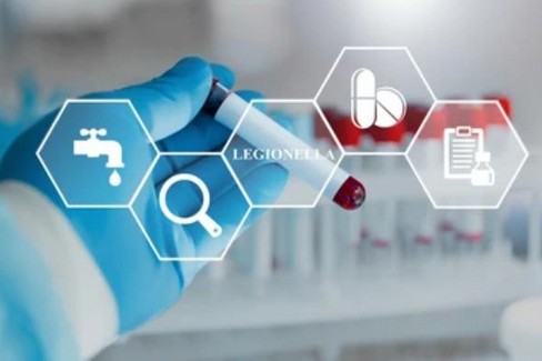 legionella