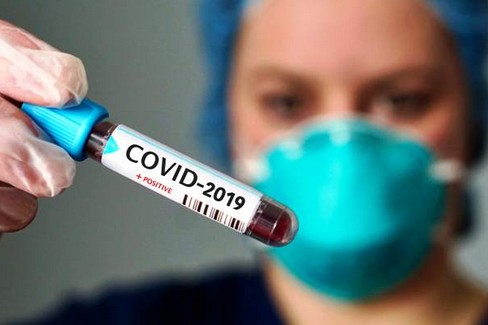 covid provetta