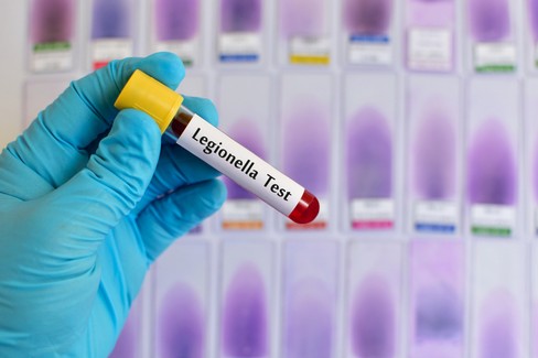 Legionella, campagna di prevenzione ASL Bari